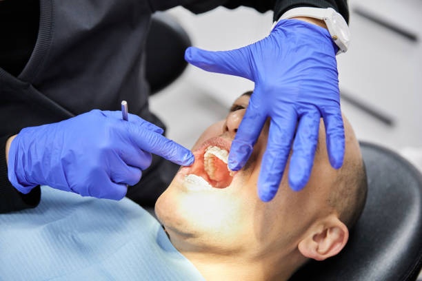 Best Emergency Dental Filling Replacement  in Mathews, LA